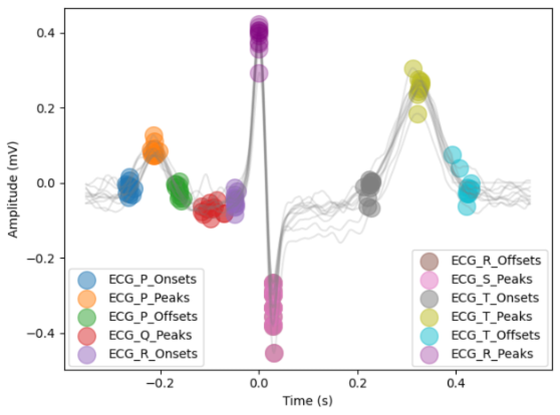 ECG fiducial points detected across beats